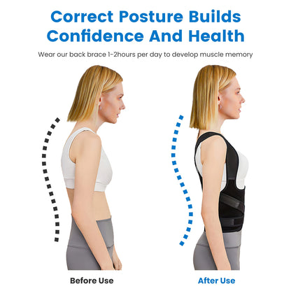 Posture Corrector Brace – Back Support Kyphosis Fix