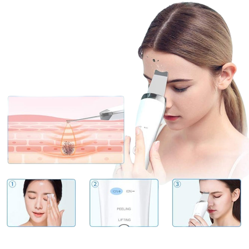 Ultrasonic Skin Scrubber – Electric Blackhead Remover Spatula